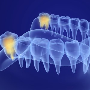 Dental 3D Imaging Specialist Near Me in Clifton, NJ Dental 3D Imaging Specialist Near Me in Clifton, NJ