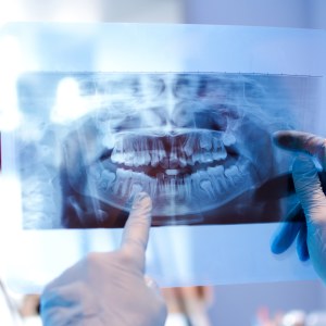 Dental 3D Imaging Specialist Near Me in Clifton, NJ Dental 3D Imaging Specialist Near Me in Clifton, NJ