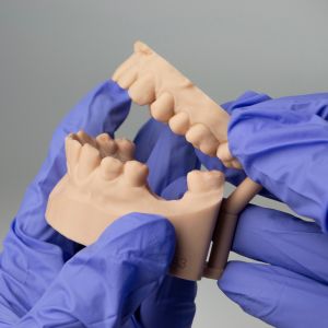 Dental Bone Grafting Specialist Near Me in Clifton, NJ