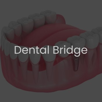 Dental Bridge Near Me in Clifton, NJ