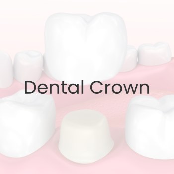 Dental Crown Near Me in Clifton, NJ