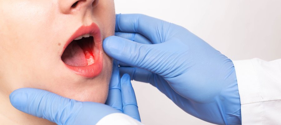 Periodontal Disease Treatment Specialist Near Me in Clifton, NJ Periodontal Disease Treatment Specialist Near Me in Clifton, NJ