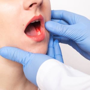 Periodontal Disease Treatment Near Me in Clifton, NJ