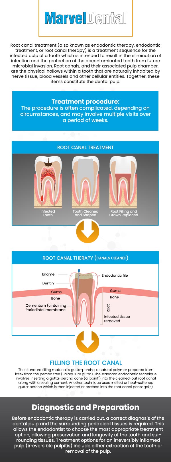 A root canal is a dental procedure that treats infections in the tooth pulp, the innermost layer of your tooth. Dr. Anna Gazu, DMD at Marvel Dental today to get comprehensive and specialized care. For more information, contact us today or book an appointment online. We are conveniently located at 1113 Main Avenue, Suite A, Clifton, NJ 07011. We serve patients from Clifton NJ, Passaic NJ, Woodland Park NJ, Nutley NJ, Garfield NJ, Fairfield NJ, and BEYOND! A root canal is a dental procedure that treats infections in the tooth pulp, the innermost layer of your tooth. Dr. Anna Gazu, DMD at Marvel Dental today to get comprehensive and specialized care. For more information, contact us today or book an appointment online. We are conveniently located at 1113 Main Avenue, Suite A, Clifton, NJ 07011. We serve patients from Clifton NJ, Passaic NJ, Woodland Park NJ, Nutley NJ, Garfield NJ, Fairfield NJ, and BEYOND!