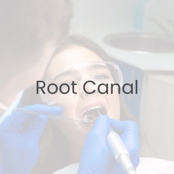 Root Canal Treatment Near Me in Clifton, NJ