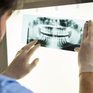 Dental X-Rays Specialist Near Me in Clifton, NJ Dental X-Rays Specialist Near Me in Clifton, NJ