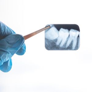 Dental X-Rays Specialist Near Me in Clifton, NJ Dental X-Rays Specialist Near Me in Clifton, NJ