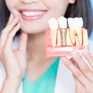 Single Tooth Dental Implant Specialist Near Me in Clifton, NJ