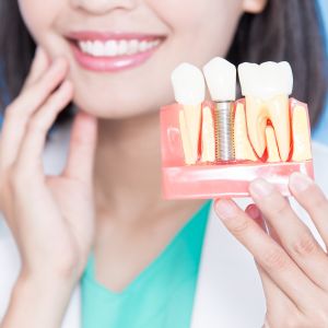 Single Tooth Dental Implant Specialist Near Me in Clifton, NJ
