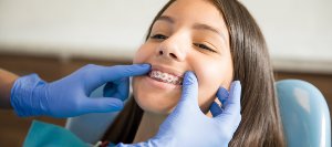 Dental Treatment for Teens Near Me in Clifton, NJ Dental Treatment for Teens Near Me in Clifton, NJ