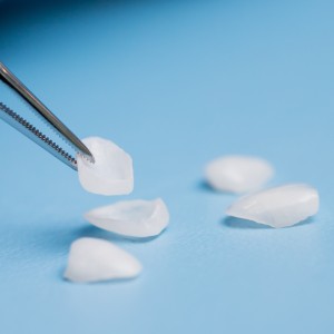 Veneers And Lumineers Specialist Near Me in Clifton, NJ