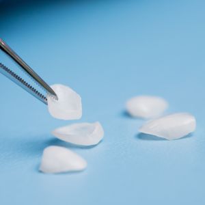 Veneers And Lumineers Specialist Near Me in Clifton, NJ