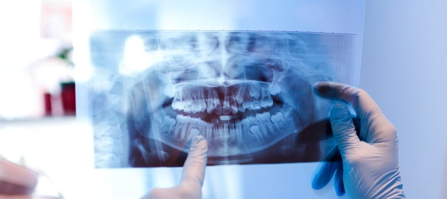 Dental 3D Imaging Near Me in Clifton, NJ Dental 3D Imaging Near Me in Clifton, NJ