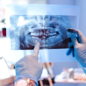 X-rays And 3d Imaging Near Me in Clifton, NJ