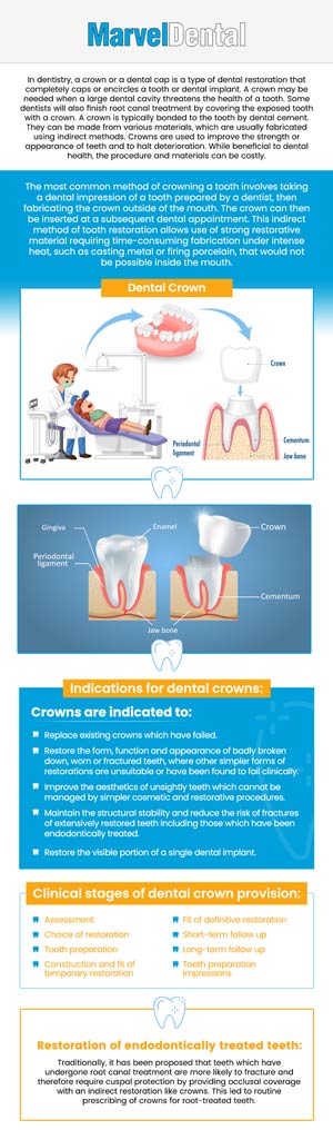 If you're considering new dental crowns in Clifton, NJ, it's essential to understand the associated costs to make informed decisions about your oral health. At Marvel Dental Practice, Dr. Anna Gazu, DMD, offers high-quality dental crowns tailored to your needs. On average, new dental crowns in the area range from $800 to $1,300, depending on factors such as material choice, tooth location, and the complexity of the procedure. For more information, contact us today or book an appointment online. We are conveniently located at 1113 Main Avenue, Suite A, Clifton, NJ 07011.