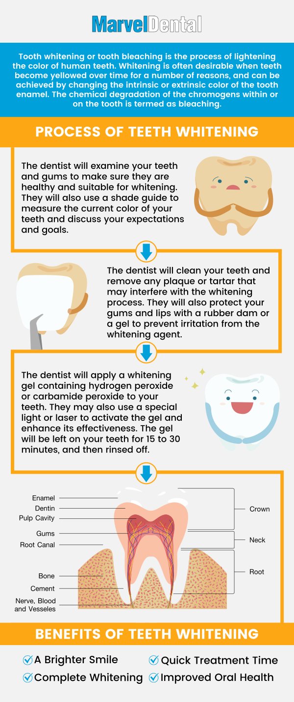 Professional teeth whitening treatments are effective and provide noticeable improvements in the color and brightness of the teeth. Visit Marvel Dental today to get comprehensive and specialized care with Dr. Anna Gazu DMD. For more information, contact us today or schedule an appointment online. Our dental practice is conveniently located at 1113 Main Avenue, Suite A, Clifton, NJ 07011. Professional teeth whitening treatments are effective and provide noticeable improvements in the color and brightness of the teeth. Visit Marvel Dental today to get comprehensive and specialized care with Dr. Anna Gazu DMD. For more information, contact us today or schedule an appointment online. Our dental practice is conveniently located at 1113 Main Avenue, Suite A, Clifton, NJ 07011.
