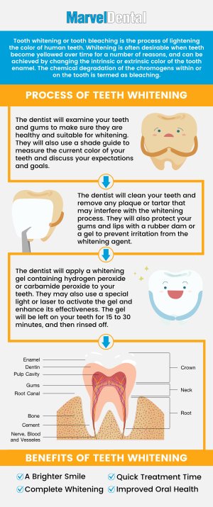 Professional teeth whitening treatments are effective and provide noticeable improvements in the color and brightness of the teeth. Visit Marvel Dental today to get comprehensive and specialized care with Dr. Anna Gazu DMD. For more information, contact us today or schedule an appointment online. Our dental practice is conveniently located at 1113 Main Avenue, Suite A, Clifton, NJ 07011. Professional teeth whitening treatments are effective and provide noticeable improvements in the color and brightness of the teeth. Visit Marvel Dental today to get comprehensive and specialized care with Dr. Anna Gazu DMD. For more information, contact us today or schedule an appointment online. Our dental practice is conveniently located at 1113 Main Avenue, Suite A, Clifton, NJ 07011.