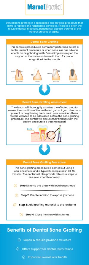 Dental bone grafting is a procedure that restores lost jaw bone, often for dental implants, by transplanting bone material to promote new growth. It is recommended for patients with tooth loss, injury, or gum disease, as it ensures implant stability and success, and supports overall oral health. At Marvel Dental in Clifton, NJ, Dr. Anna Gazu, DMD offers comprehensive dental bone grafting services to help patients restore their smiles and oral function. For more information, contact us today or schedule an appointment online. Our dental practice is conveniently located at 1113 Main Avenue, Suite A, Clifton, NJ 07011. Dental bone grafting is a procedure that restores lost jaw bone, often for dental implants, by transplanting bone material to promote new growth. It is recommended for patients with tooth loss, injury, or gum disease, as it ensures implant stability and success, and supports overall oral health. At Marvel Dental in Clifton, NJ, Dr. Anna Gazu, DMD offers comprehensive dental bone grafting services to help patients restore their smiles and oral function. For more information, contact us today or schedule an appointment online. Our dental practice is conveniently located at 1113 Main Avenue, Suite A, Clifton, NJ 07011.