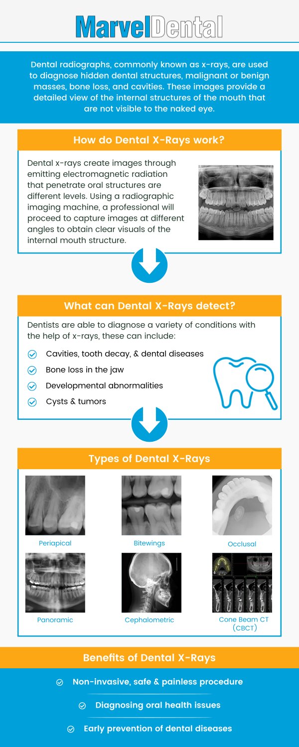 For precision in diagnosis and exceptional dental care, visit Marvel Dental in Clifton, NJ, where Dr. Anna Gazu, DMD, offers state-of-the-art dental X-ray services. Our advanced imaging technology aids in detecting hidden dental issues early, ensuring accurate treatments tailored to your needs. Trust Dr. Gazu and her team for a comprehensive approach to your oral health. For more information, contact us today or schedule an appointment online. Our dental practice is conveniently located at 1113 Main Avenue, Suite A, Clifton, NJ 07011. For precision in diagnosis and exceptional dental care, visit Marvel Dental in Clifton, NJ, where Dr. Anna Gazu, DMD, offers state-of-the-art dental X-ray services. Our advanced imaging technology aids in detecting hidden dental issues early, ensuring accurate treatments tailored to your needs. Trust Dr. Gazu and her team for a comprehensive approach to your oral health. For more information, contact us today or schedule an appointment online. Our dental practice is conveniently located at 1113 Main Avenue, Suite A, Clifton, NJ 07011.