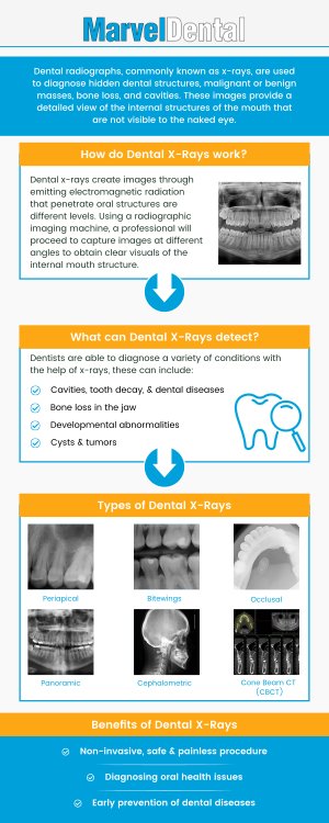 For precision in diagnosis and exceptional dental care, visit Marvel Dental in Clifton, NJ, where Dr. Anna Gazu, DMD, offers state-of-the-art dental X-ray services. Our advanced imaging technology aids in detecting hidden dental issues early, ensuring accurate treatments tailored to your needs. Trust Dr. Gazu and her team for a comprehensive approach to your oral health. For more information, contact us today or schedule an appointment online. Our dental practice is conveniently located at 1113 Main Avenue, Suite A, Clifton, NJ 07011. For precision in diagnosis and exceptional dental care, visit Marvel Dental in Clifton, NJ, where Dr. Anna Gazu, DMD, offers state-of-the-art dental X-ray services. Our advanced imaging technology aids in detecting hidden dental issues early, ensuring accurate treatments tailored to your needs. Trust Dr. Gazu and her team for a comprehensive approach to your oral health. For more information, contact us today or schedule an appointment online. Our dental practice is conveniently located at 1113 Main Avenue, Suite A, Clifton, NJ 07011.