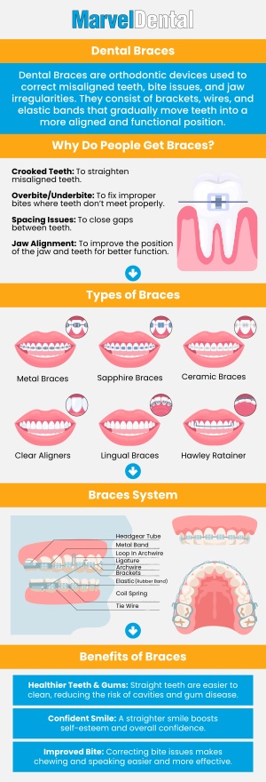 Dr. Anna Gazu, DMD at Marvel Dental offers affordable braces in Clifton, NJ to help you achieve a confident smile. Our team provides personalized treatment plans to fit your needs. Whether you're looking for traditional metal braces or clear aligners, we offer options that suit your lifestyle and budget. For more information, contact us today or book an appointment online. We are conveniently located at 1113 Main Avenue, Suite A, Clifton, NJ 07011. Dr. Anna Gazu, DMD at Marvel Dental offers affordable braces in Clifton, NJ to help you achieve a confident smile. Our team provides personalized treatment plans to fit your needs. Whether you're looking for traditional metal braces or clear aligners, we offer options that suit your lifestyle and budget. For more information, contact us today or book an appointment online. We are conveniently located at 1113 Main Avenue, Suite A, Clifton, NJ 07011.