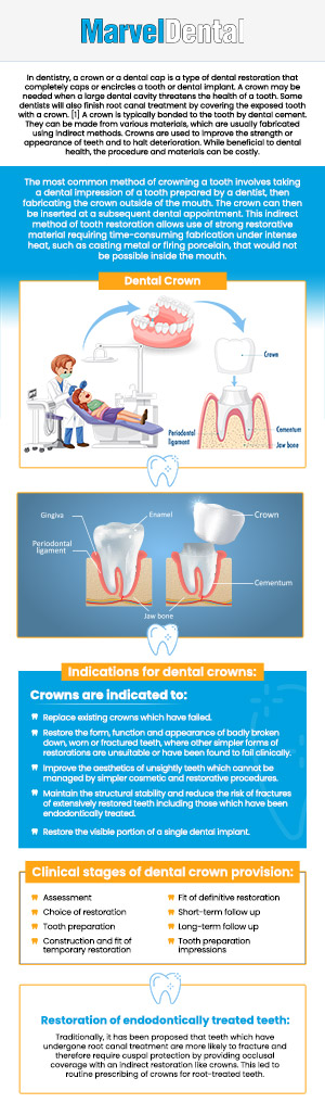 At Marvel Dental in Clifton, NJ, Dr. Anna Gazu, DMD, excels in providing high-quality dental crowns tailored to fit perfectly and look natural. Our clinic specializes in restoring your smile's strength and aesthetics with durable crowns designed to match your tooth's color and shape. Trust Dr. Gazu for expert care that brings lasting solutions and a beautiful smile. For more information, contact us today or schedule an appointment online. We are conveniently located at 1113 Main Avenue, Suite A, Clifton, NJ 07011. At Marvel Dental in Clifton, NJ, Dr. Anna Gazu, DMD, excels in providing high-quality dental crowns tailored to fit perfectly and look natural. Our clinic specializes in restoring your smile's strength and aesthetics with durable crowns designed to match your tooth's color and shape. Trust Dr. Gazu for expert care that brings lasting solutions and a beautiful smile. For more information, contact us today or schedule an appointment online. We are conveniently located at 1113 Main Avenue, Suite A, Clifton, NJ 07011.